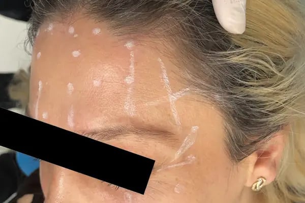 Özel Smile Center Van Ağız ve Diş sağlığı polikliniği - Resim 9