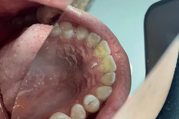 Özel Smile Center Van Ağız ve Diş sağlığı polikliniği - Resim 12