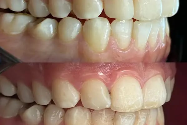 Özel Smile Center Van Ağız ve Diş sağlığı polikliniği - Resim 19