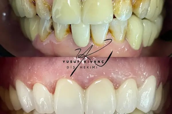 Özel Smile Center Van Ağız ve Diş sağlığı polikliniği - Resim 1