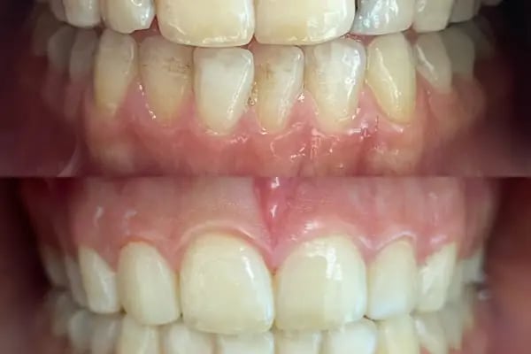 Özel Smile Center Van Ağız ve Diş sağlığı polikliniği - Resim 14