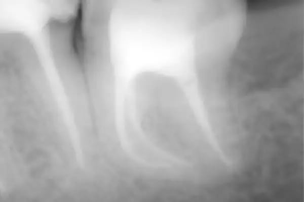 Özel Smile Center Van Ağız ve Diş sağlığı polikliniği - Resim 15