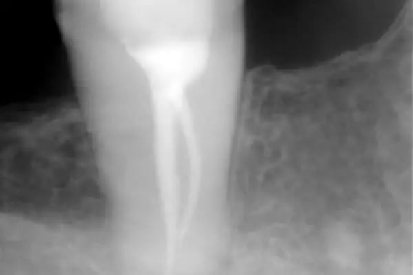 Özel Smile Center Van Ağız ve Diş sağlığı polikliniği - Resim 16