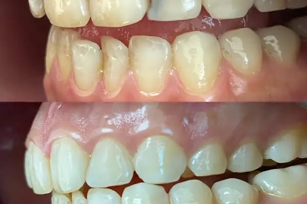 Özel Smile Center Van Ağız ve Diş sağlığı polikliniği - Resim 7