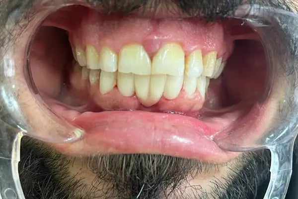 Özel Dent 35 Ağız ve Diş Sağlığı Polikliniği Alsancak - Resim 12