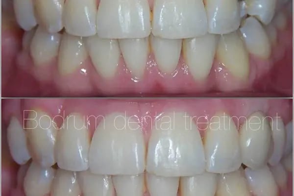 DİŞ HEKİMİ NİHAN KUDAY - Resim 15