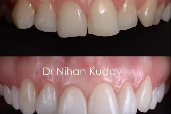 DİŞ HEKİMİ NİHAN KUDAY - Resim 18