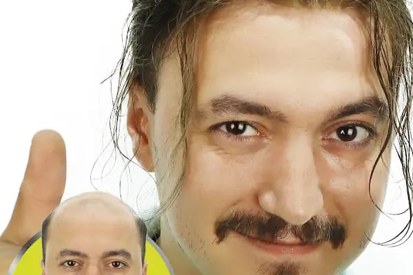 SWell Hair Protez Saç ve Gerçek Saç Peruk Merkezi Şişli - Hair Replacement - Medical Wigs - Resim 13