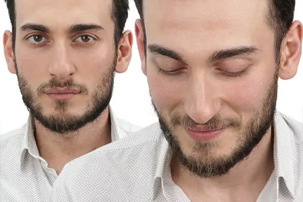 SWell Hair Protez Saç ve Gerçek Saç Peruk Merkezi Şişli - Hair Replacement - Medical Wigs - Resim 19