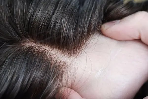 SWell Hair Protez Saç ve Gerçek Saç Peruk Merkezi Şişli - Hair Replacement - Medical Wigs - Resim 4