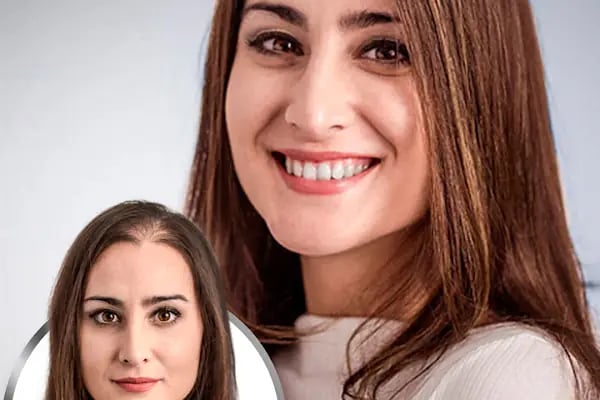 SWell Hair Protez Saç ve Gerçek Saç Peruk Merkezi Şişli - Hair Replacement - Medical Wigs - Resim 10