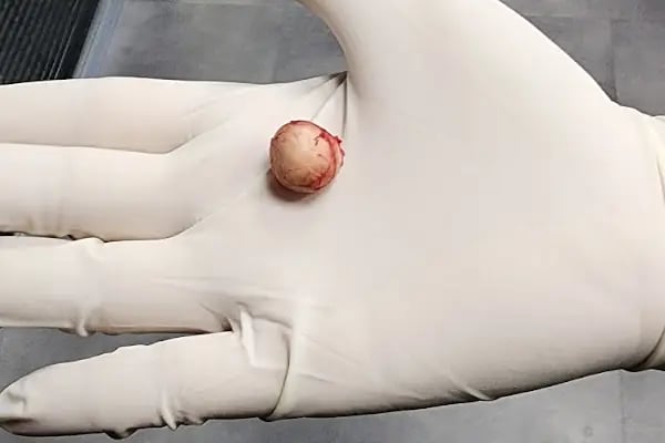 Op. Dr. C. Özerk Demiralp - Plastik, Rekonstrüktif ve Estetik Cerrahi Uzmanı - Resim 4