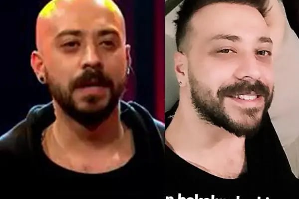 Newhair İzmir, Protez saç, Saç Protezi, Saç Ekimi, Kemoterapi, Hair Replacement, Toupee - Resim 10