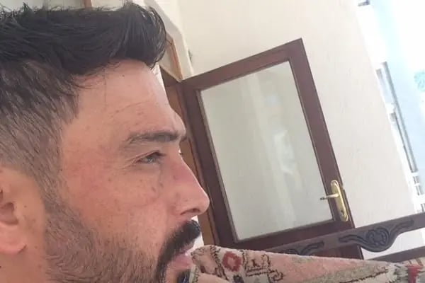 Newhair İzmir, Protez saç, Saç Protezi, Saç Ekimi, Kemoterapi, Hair Replacement, Toupee - Resim 12
