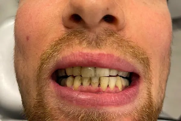 Bodrum Dental Ağız ve Diş Sağlığı Polikliniği Alev Kumbaracı - Resim 16