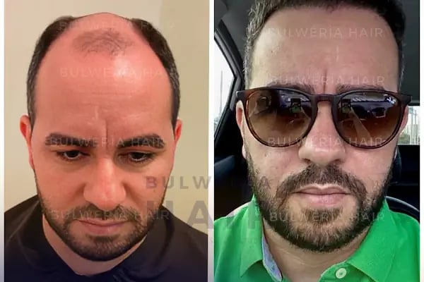 Bulweria Hair - Istanbul - Resim 9