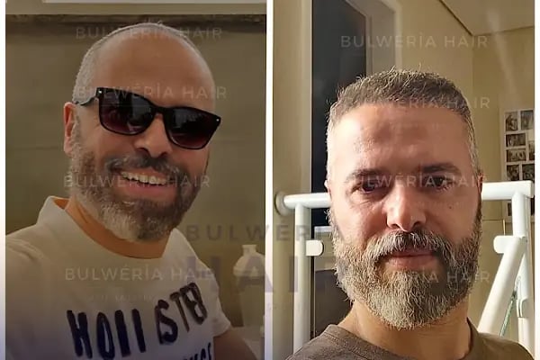 Bulweria Hair - Istanbul - Resim 11