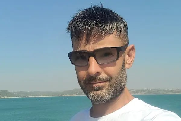 Adana Protez Saç Merkezi - Resim 18