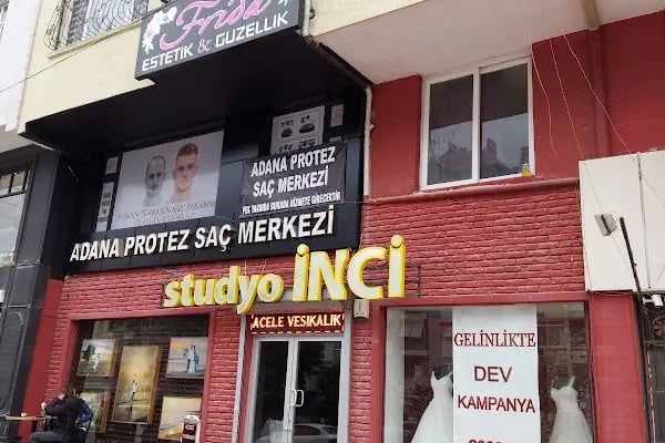 Adana Protez Saç Merkezi - Resim 7