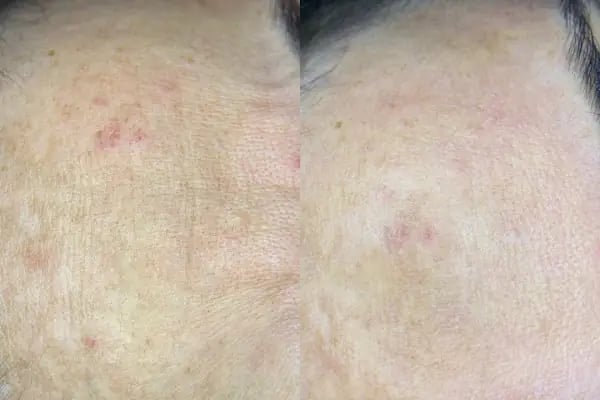 ASEL GÜZELLİK VE BÖLGESEL ZAYIFLAMA MERKEZİ - Resim 17