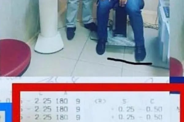 METAGÖZ Malatya - Göz Lazer Merkezi - Resim 6