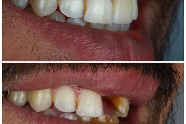 Özkan Karabat Dental Studio - Resim 5
