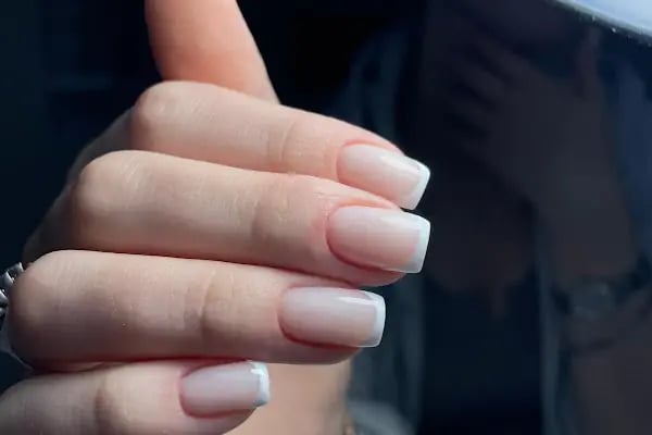Queen♛ Kozmetoloji ❘ Dermatoloji Ankara ☪ - Resim 7