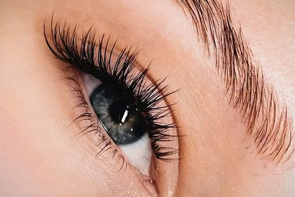 Queen♛ Kozmetoloji ❘ Dermatoloji Ankara ☪ - Resim 2