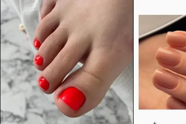 Queen♛ Kozmetoloji ❘ Dermatoloji Ankara ☪ - Resim 10