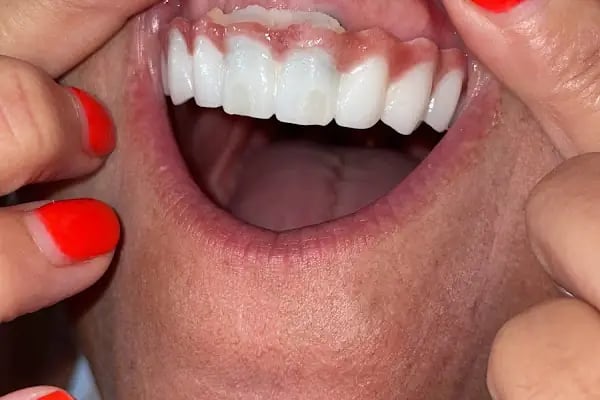 Cerrahi Grup Avcılar Ağız ve Diş Sağlığı Polikliniği - Resim 19