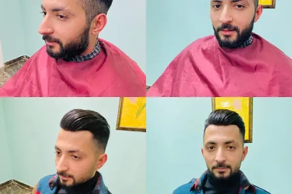 serkan cengiz protez saç merkezi adana - Resim 12