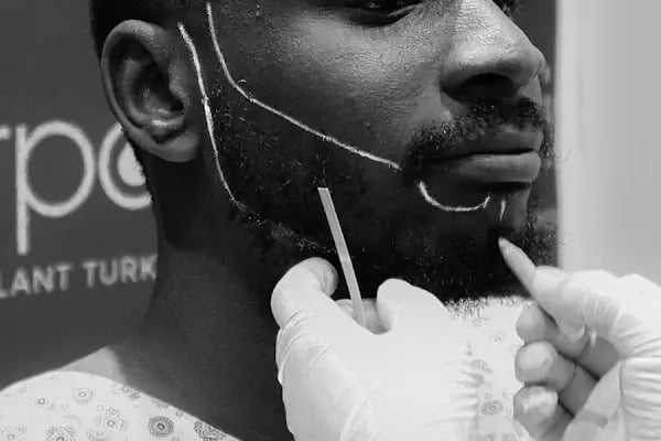Hairpol | Hair Transplant Clinic (Saç Ekimi Kliniği) - Resim 17