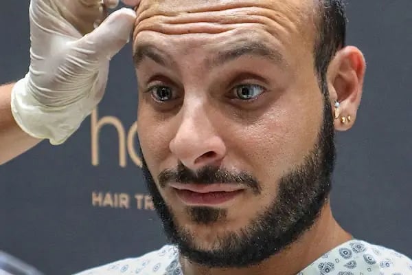 Hairpol | Hair Transplant Clinic (Saç Ekimi Kliniği) - Resim 10