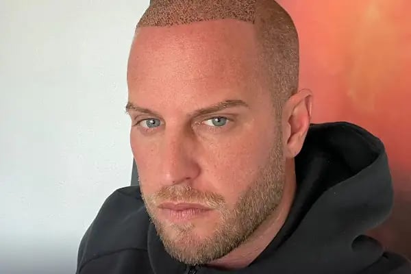 Hairpol | Hair Transplant Clinic (Saç Ekimi Kliniği) - Resim 14