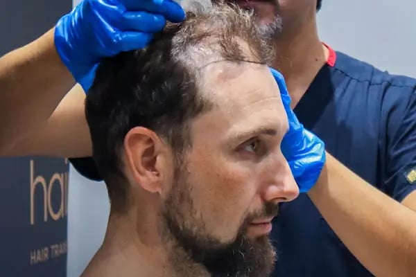 Hairpol | Hair Transplant Clinic (Saç Ekimi Kliniği) - Resim 19