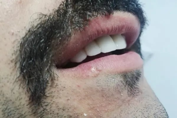 DETAY DENT DİŞ KLİNİĞİ - Resim 6