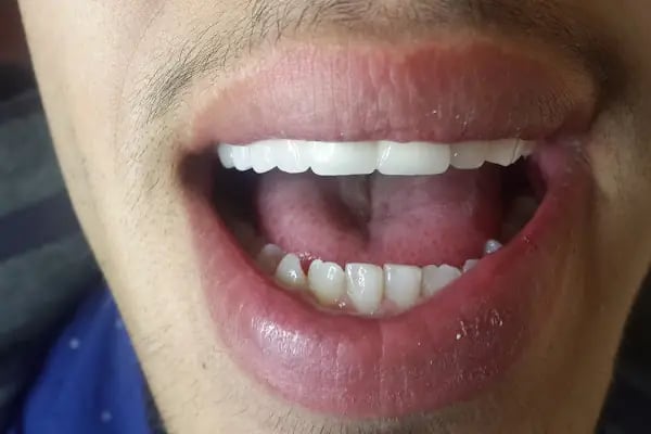DETAY DENT DİŞ KLİNİĞİ - Resim 7
