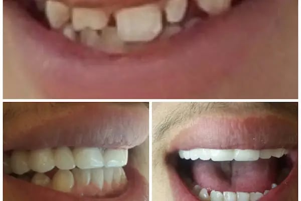 DETAY DENT DİŞ KLİNİĞİ - Resim 8