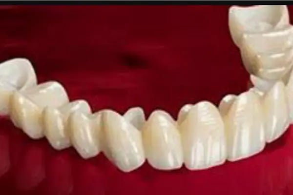 DETAY DENT DİŞ KLİNİĞİ - Resim 4