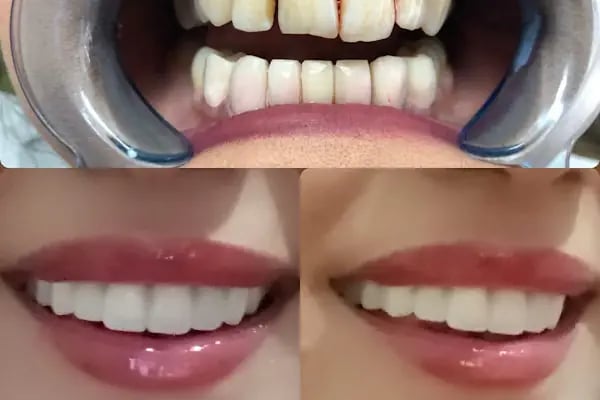 DETAY DENT DİŞ KLİNİĞİ - Resim 11