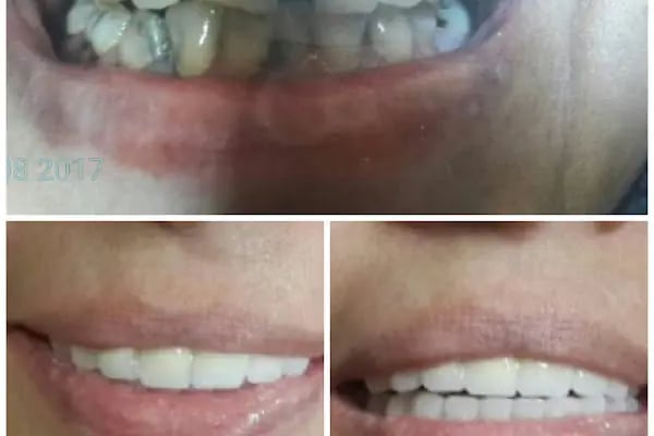 DETAY DENT DİŞ KLİNİĞİ - Resim 10