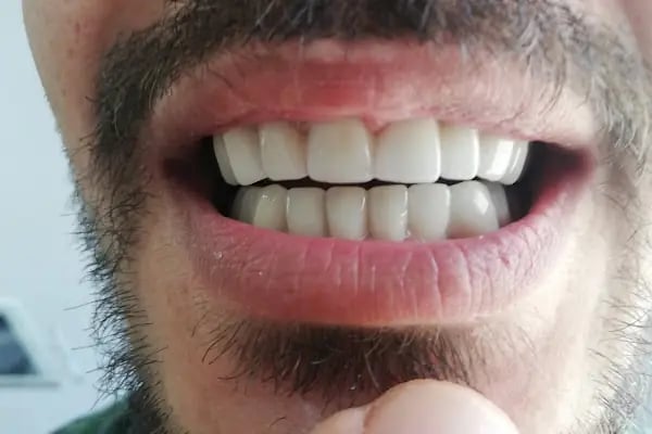 DETAY DENT DİŞ KLİNİĞİ - Resim 3