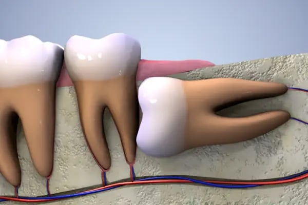 Özel Gap Dental Ağız ve Diş Sağlığı Polikliniği - Resim 6