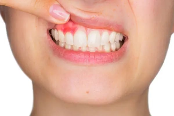 Özel Gap Dental Ağız ve Diş Sağlığı Polikliniği - Resim 3