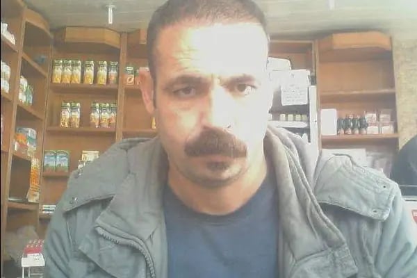 SULTAN ÖZMEN HAIR CLINIC - Resim 7