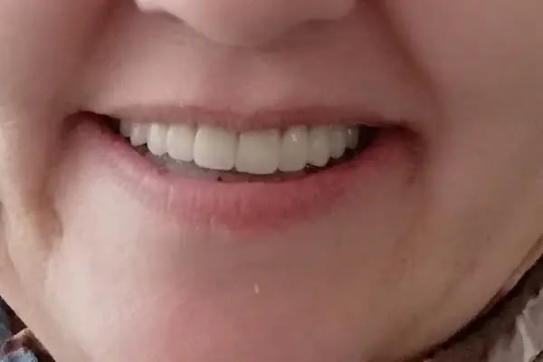 Özel Özeralp Ağız ve Diş Sağlığı Polikliniği - Resim 11