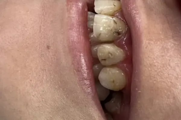 Özel Özeralp Ağız ve Diş Sağlığı Polikliniği - Resim 6