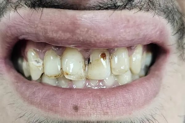 AvrupaDiş Avcılar Ağız ve Diş Sağlığı Polikliniği - Resim 19