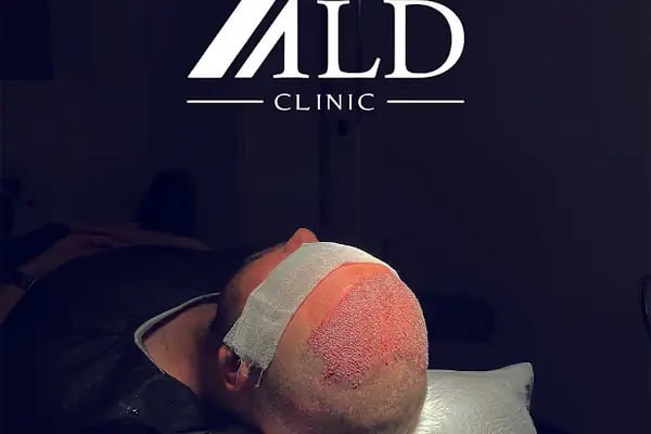 ALD Hair Clinic - Resim 15