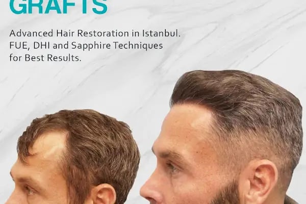 ALD Hair Clinic - Resim 9